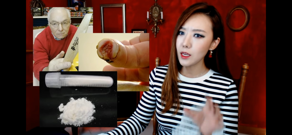 돼지 방광으로 잘린손가락 재생사례(손가락사진 주의) | 인스티즈