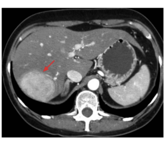 유병 인구 중 95%가 2030 여성이라는 이 질환 | 인스티즈