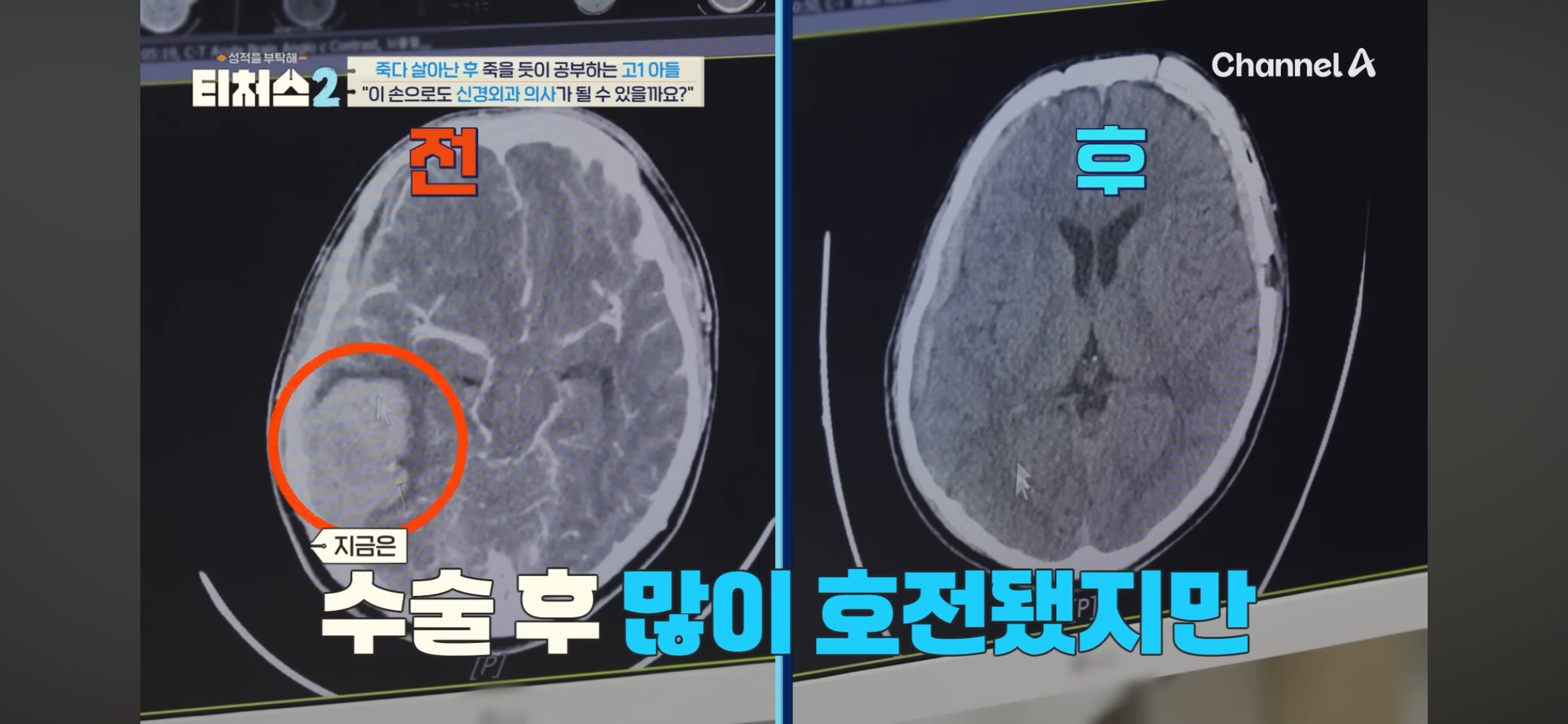 의대 가고싶어 하는 아들 vs 안가길 바라는 부모님 | 인스티즈
