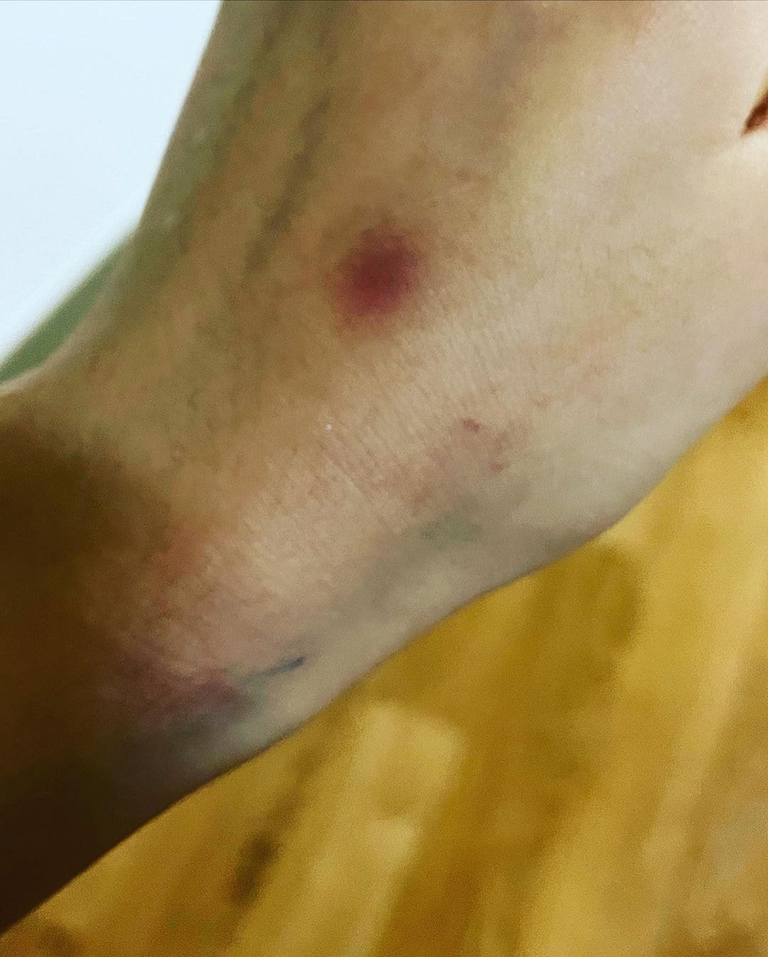 '결혼과이혼사이' 남편한테 폭행당했다는 서사랑 인스타 입장문.jpg (사진 트리거 주의) | 인스티즈