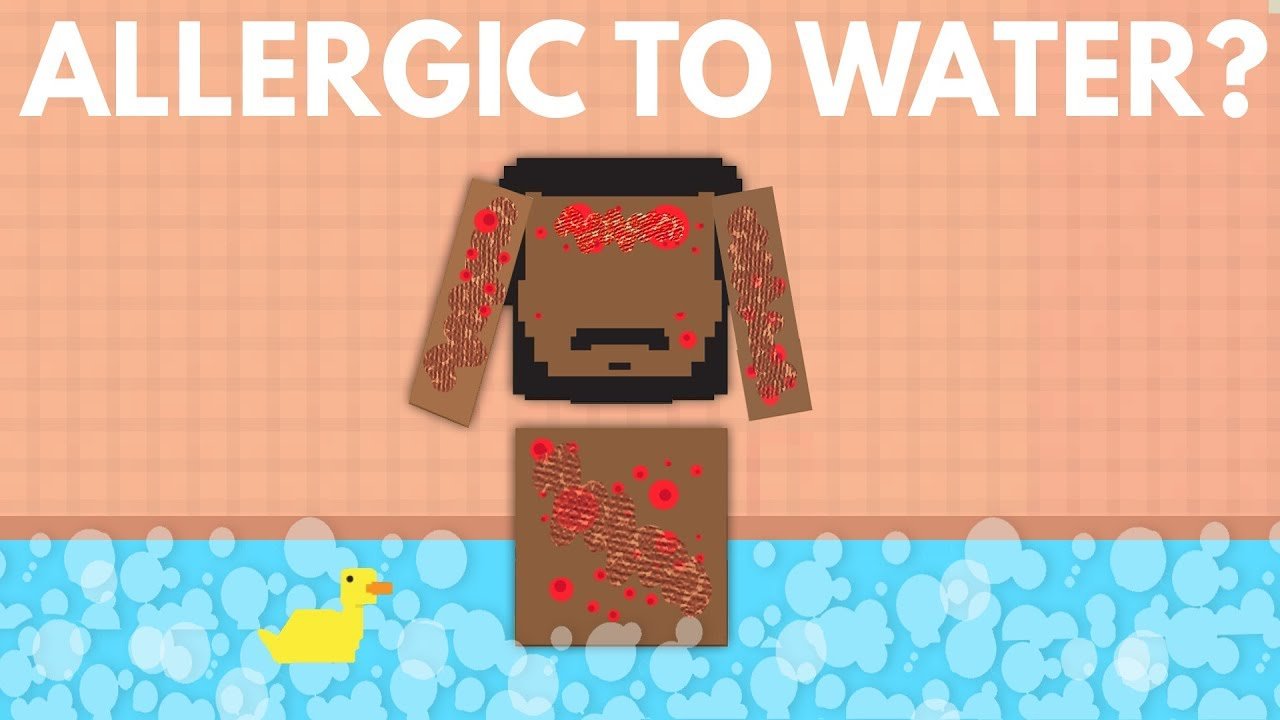 물에 알레르기가 생기는 최악의 병 | 인스티즈
