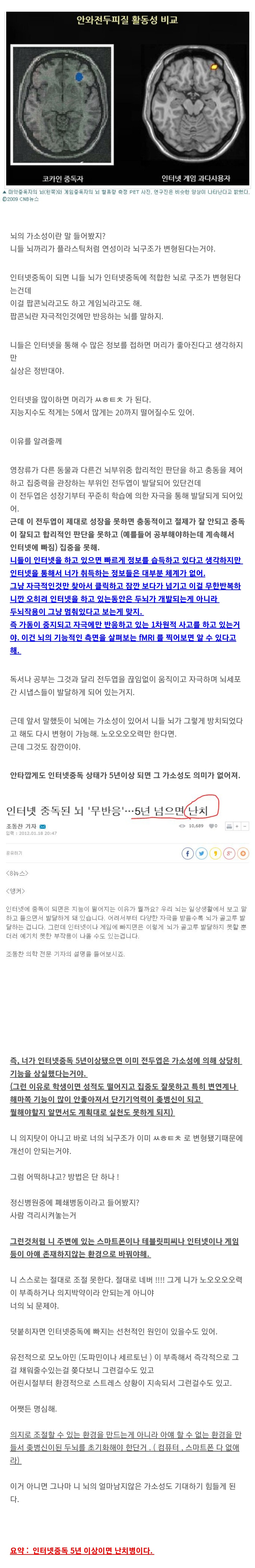인터넷 중독 5년이상이면 뇌회복 불가.jpg | 인스티즈