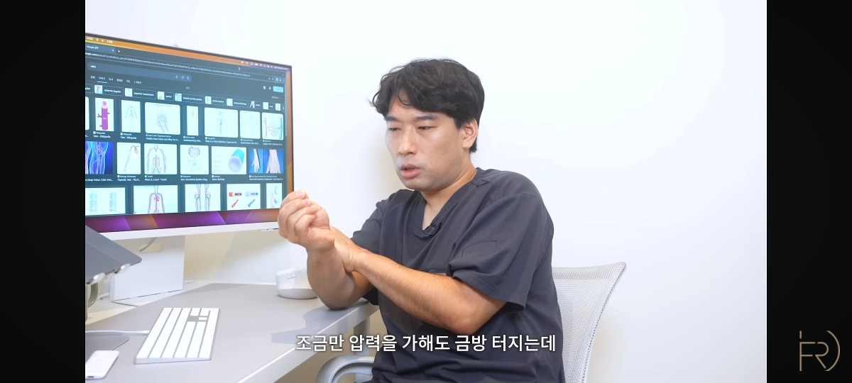 의사가 말하는 종아리 마사지(기계) 하지말아야하는 이유.jpg | 인스티즈