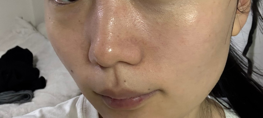 토마토 스킨케어 이미지