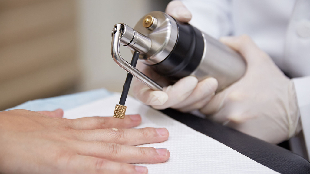 해본사람마다 통증 후기가 완전 갈리는 피부과 치료 | 인스티즈