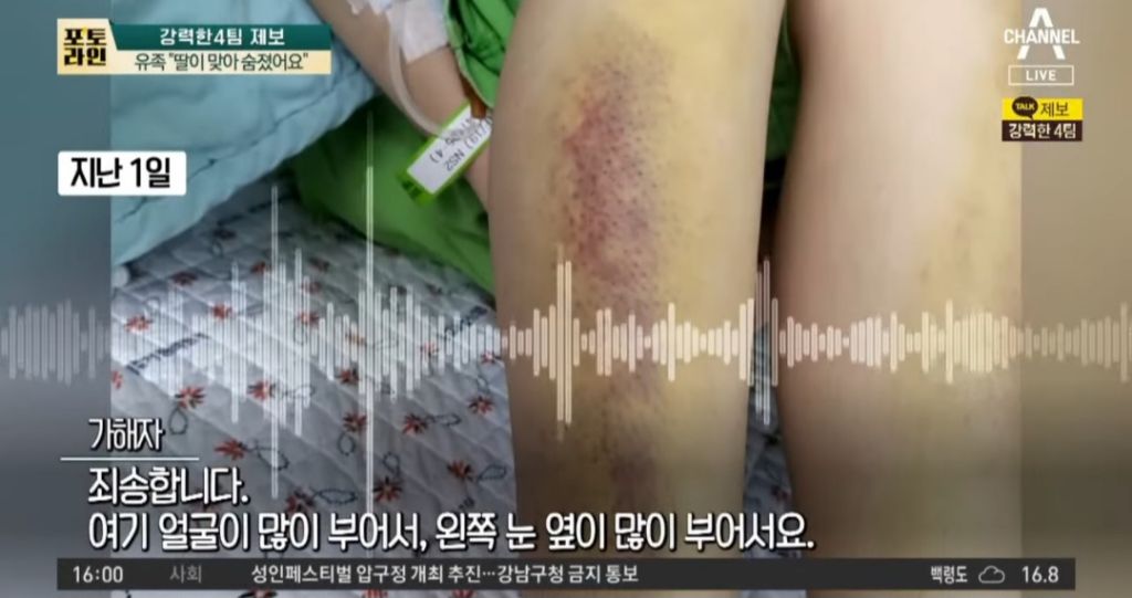 유족이 얼굴 공개한 전남친 폭행으로 사망한 여성 | 인스티즈