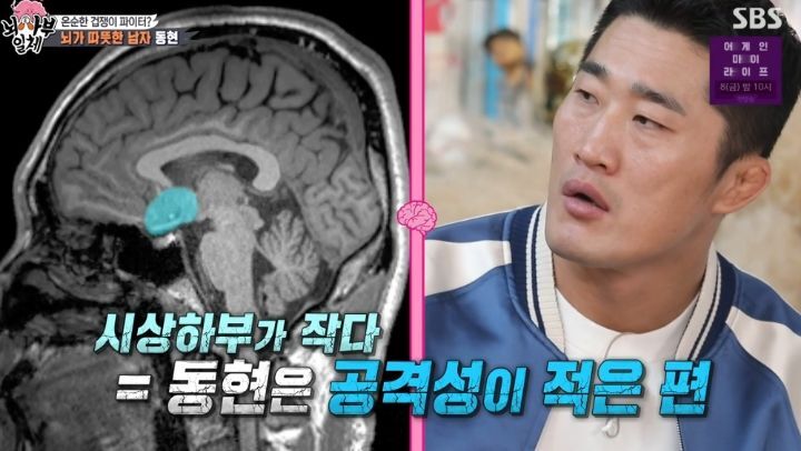 [집사부일체] 최고의 뇌과학자가 분석한 양세형, 리정, 이승기, 유수빈, 김동현 뇌 MRI 결과 | 인스티즈