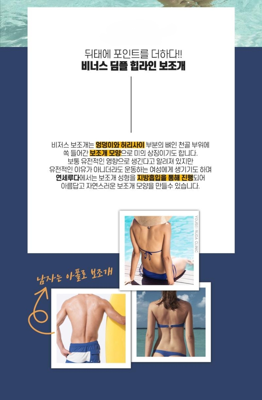 해외에서 유행하다가 우리나라에서도 시행하는 성형부위.jpg | 인스티즈