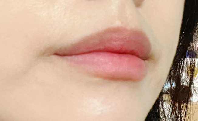 블러썸 이미지