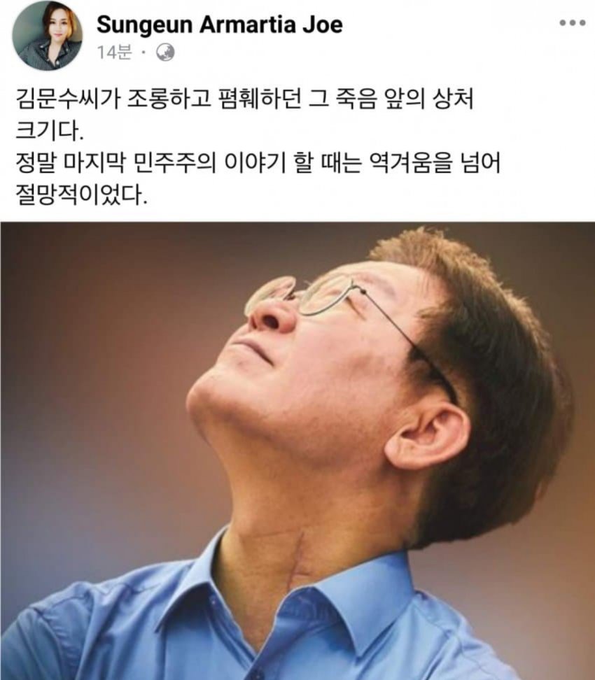 이재명 칼테러 사건의 상처크기 | 인스티즈