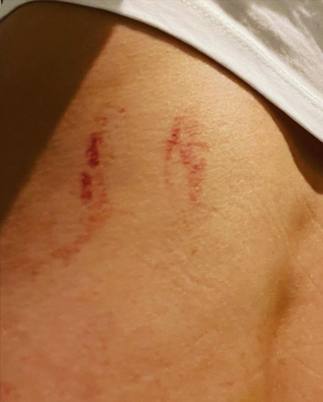 '결혼과이혼사이' 남편한테 폭행당했다는 서사랑 인스타 입장문.jpg (사진 트리거 주의) | 인스티즈