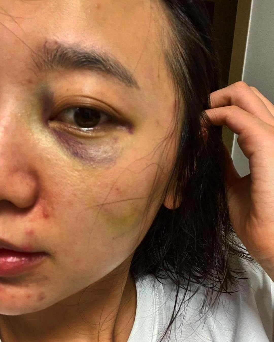 '결혼과이혼사이' 남편한테 폭행당했다는 서사랑 인스타 입장문.jpg (사진 트리거 주의) | 인스티즈