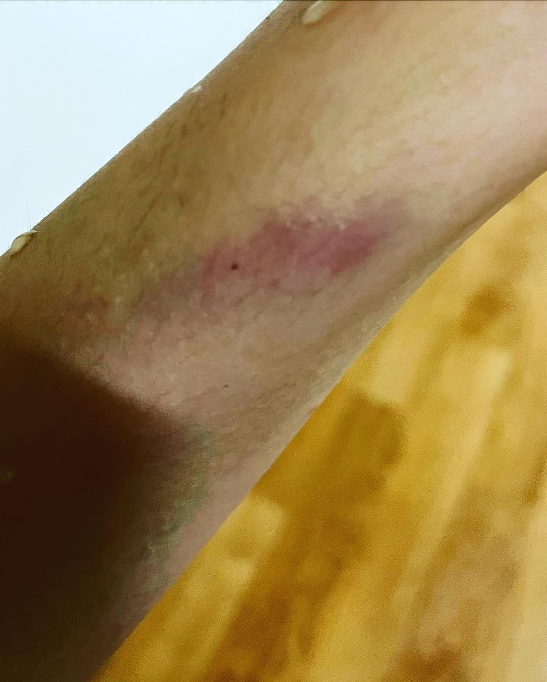 '결혼과이혼사이' 남편한테 폭행당했다는 서사랑 인스타 입장문.jpg (사진 트리거 주의) | 인스티즈