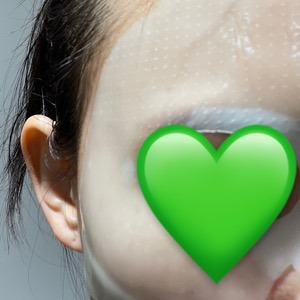 리페어 이미지