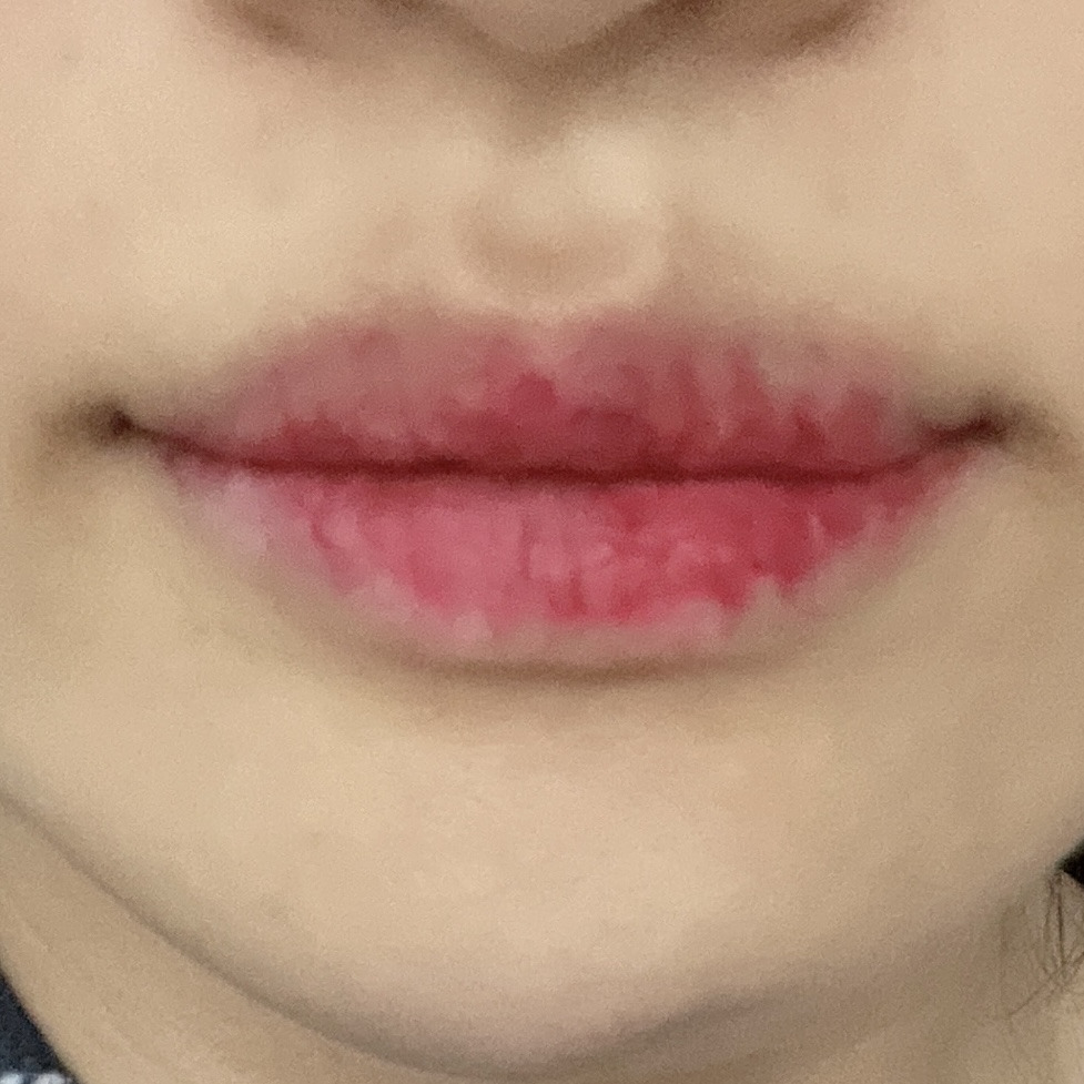 블러썸 이미지
