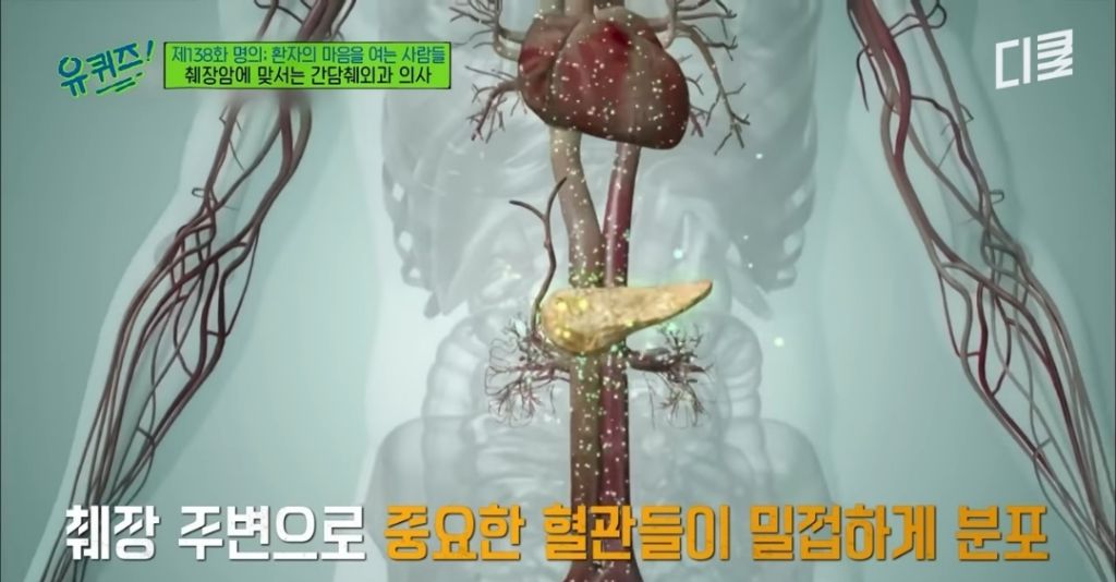 초기 발견이 어렵다는 췌장암이 의심되는 증상 | 인스티즈
