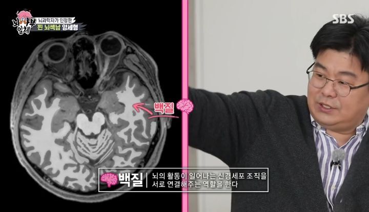 [집사부일체] 최고의 뇌과학자가 분석한 양세형, 리정, 이승기, 유수빈, 김동현 뇌 MRI 결과 | 인스티즈