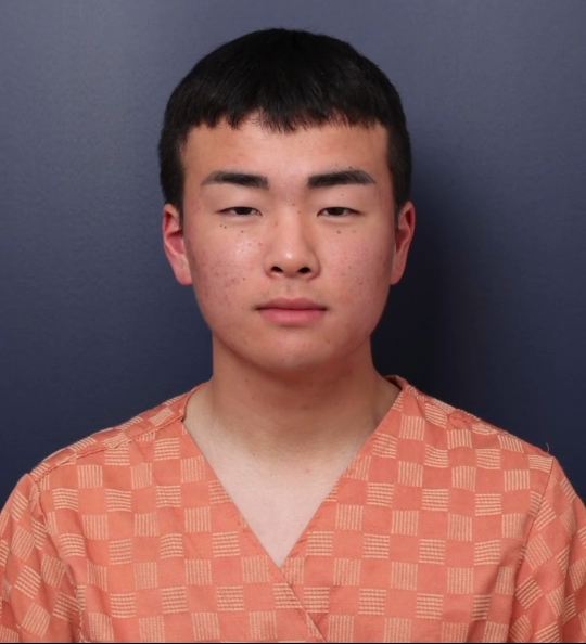 남자 성형 전후 눈+코+매부리교정 | 인스티즈