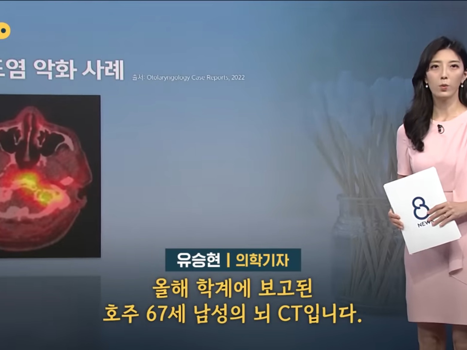 [SBS뉴스] "귓밥 못 참고 팠는데…” 상상도 못할 곳에 퍼졌다 | 인스티즈