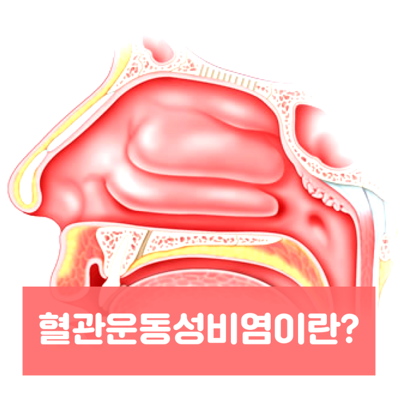 사회생활 테러 암살자 1순위 개그지같은 불치병 | 인스티즈