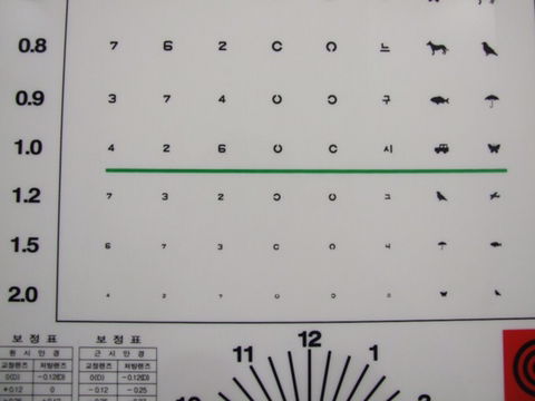 시력이 마이너스라고 말하는 사람들 보면 가슴이 콱 막히는 달글 | 인스티즈