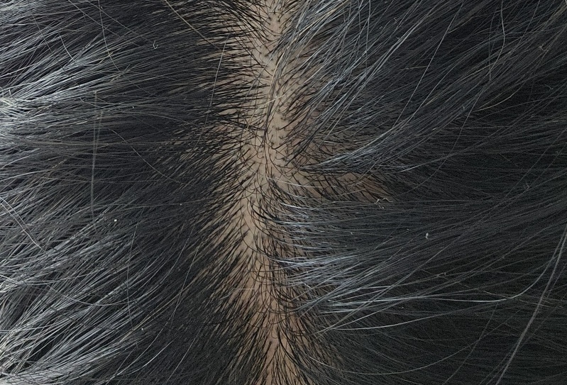 리페어링 이미지