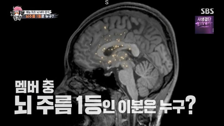 [집사부일체] 최고의 뇌과학자가 분석한 양세형, 리정, 이승기, 유수빈, 김동현 뇌 MRI 결과 | 인스티즈