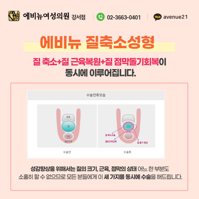 에비뉴여성의원 이미지