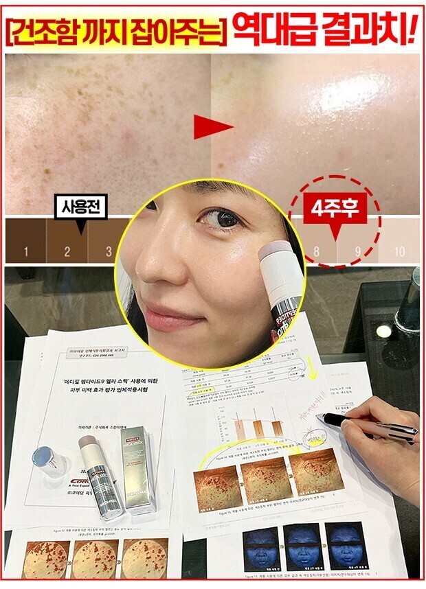 스틱톡스 이미지
