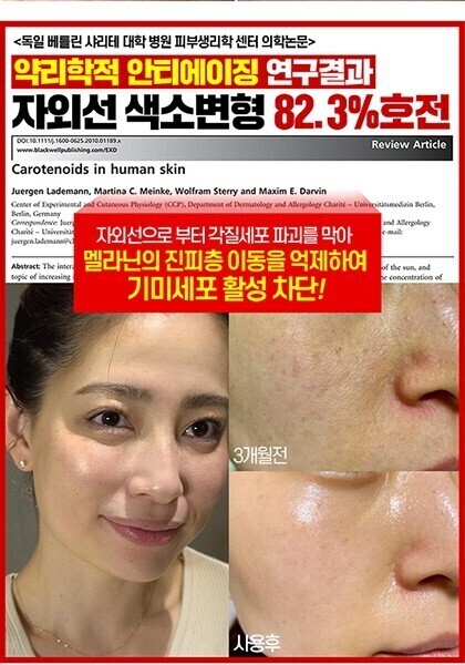 스틱톡스 이미지