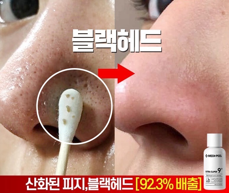 지.피.지 이미지