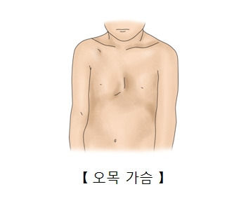 오목이네 이미지