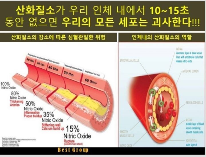 셀피아 이미지