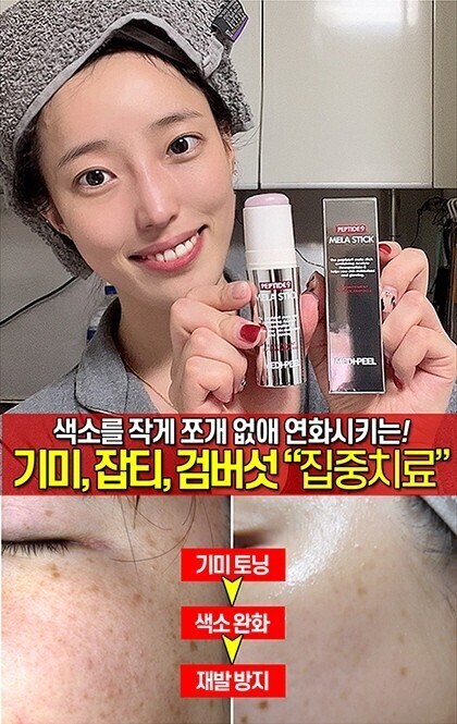 스틱톡스 이미지