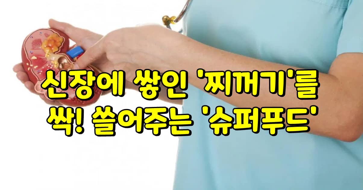 신장슈퍼 이미지