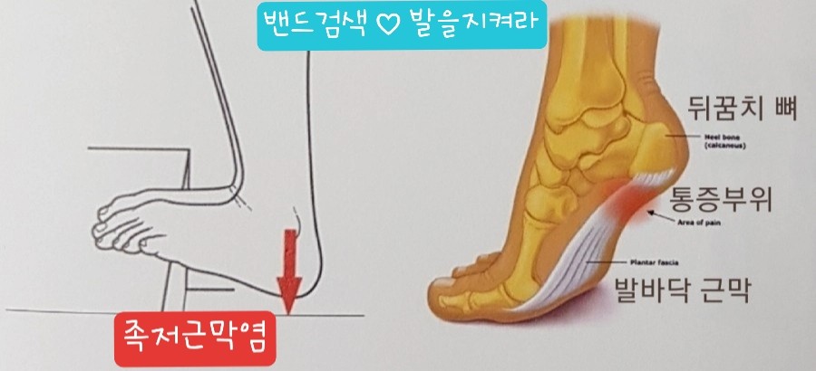힘줄 이미지