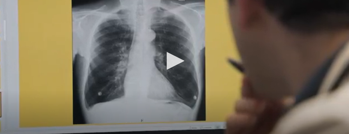 [충격] 전자담배는 충분히 해로움 | 인스티즈