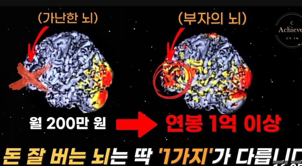 머니테라피 이미지