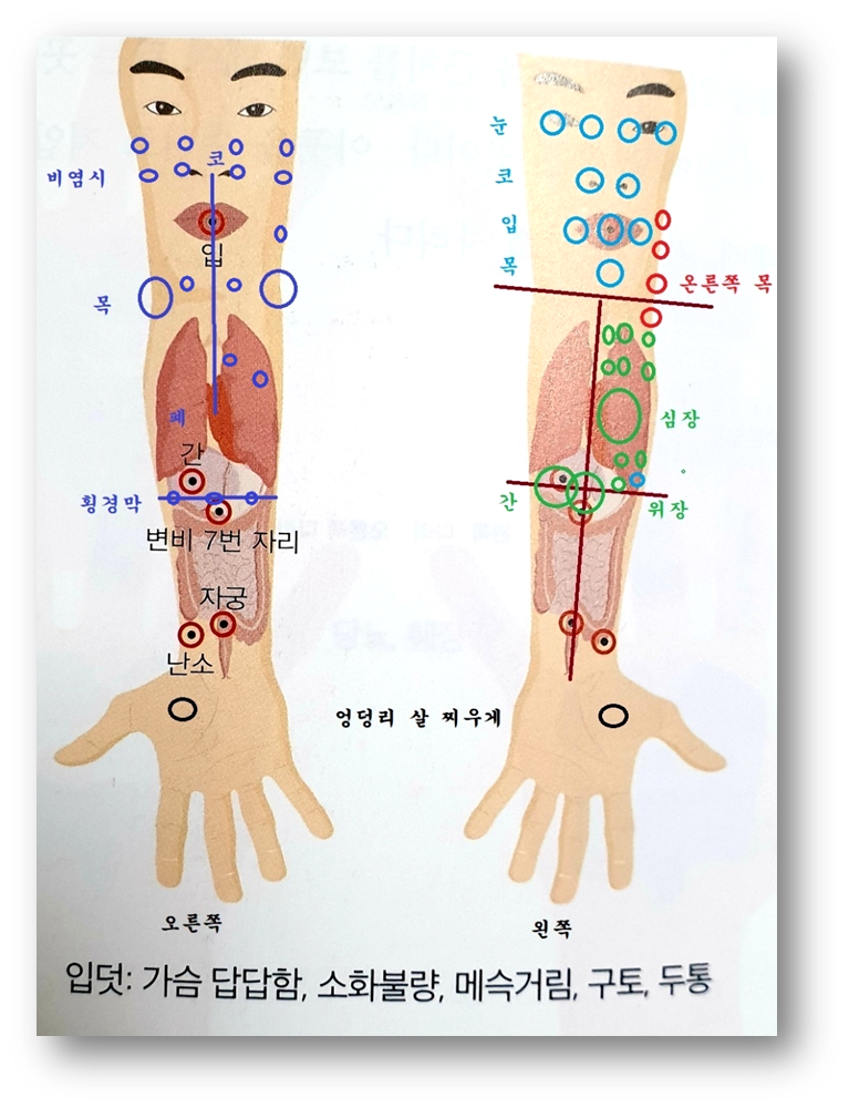 종부테라피 이미지