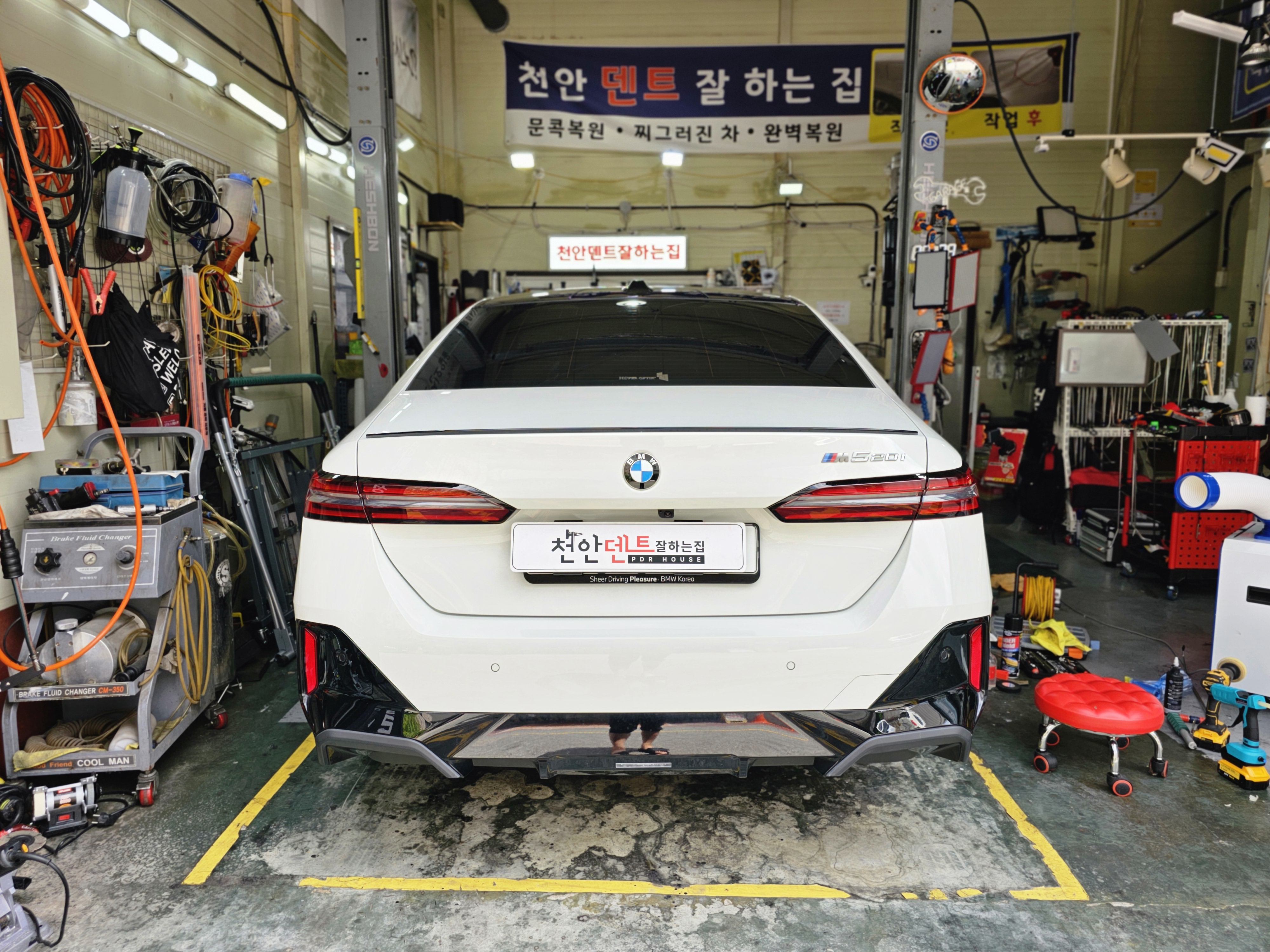 덴트 이미지