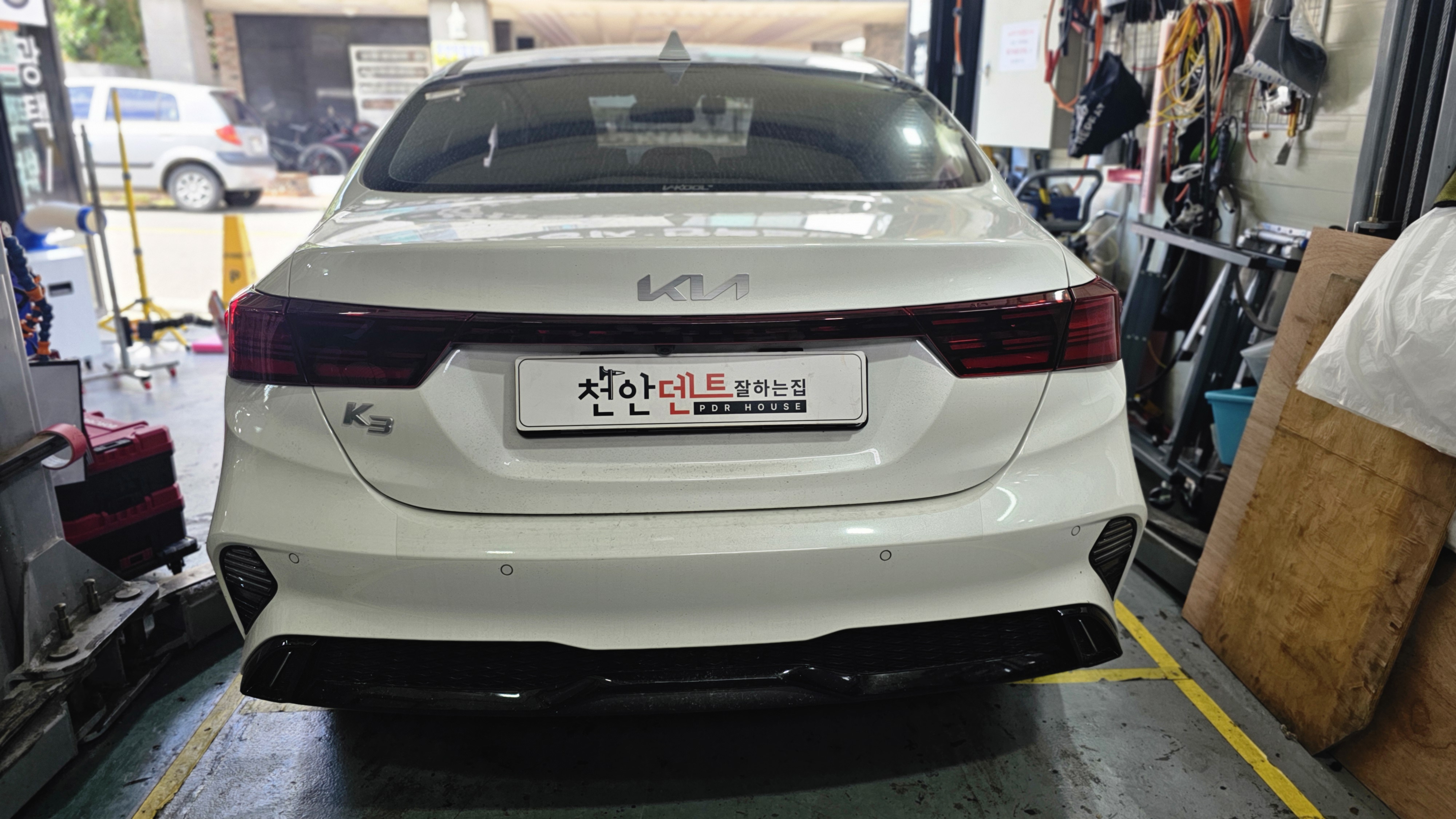 덴트 이미지