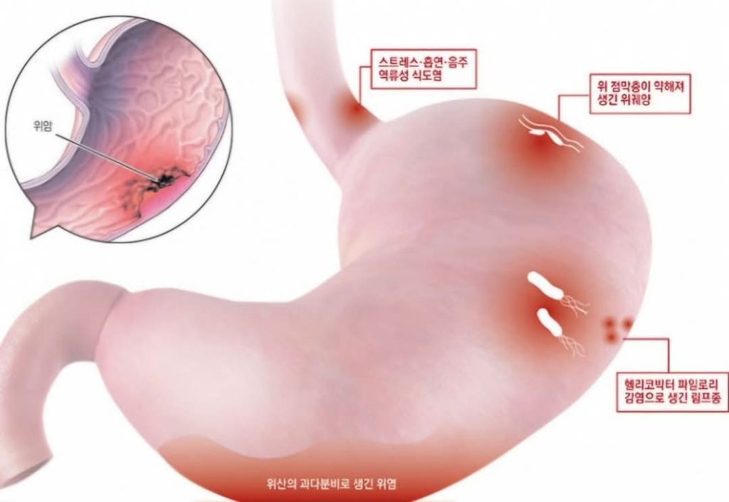 다루야 이미지