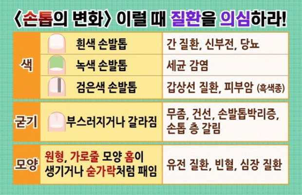 손톱별 이미지