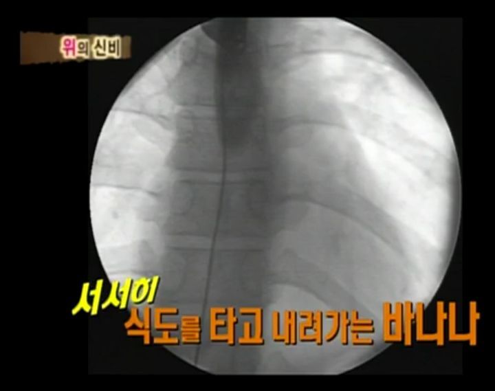 [인체탐험대] 슈주멤들의 '위'의 신비 실험 | 인스티즈