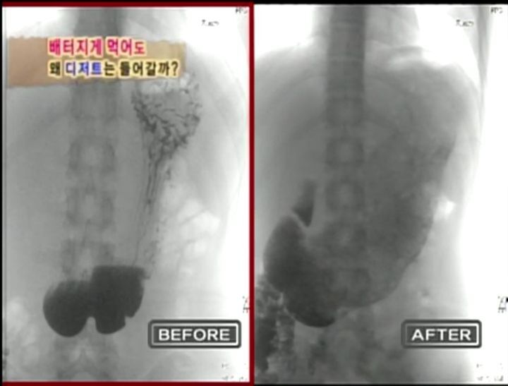 [인체탐험대] 슈주멤들의 '위'의 신비 실험 | 인스티즈