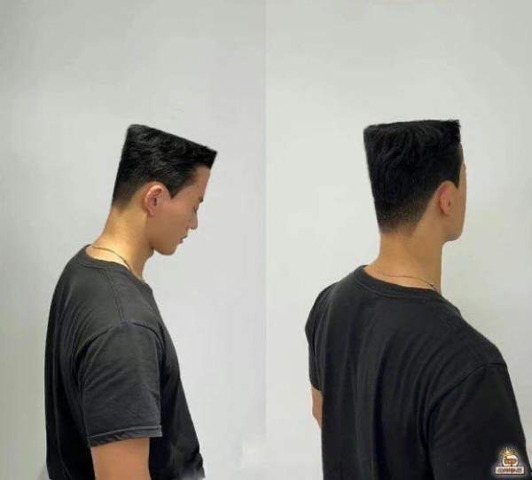 머리 이미지