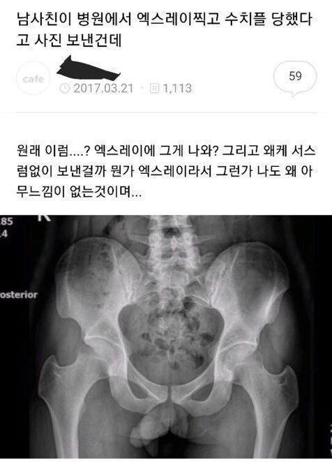 (스압) 보건소남 정말 편견 없네.. | 인스티즈