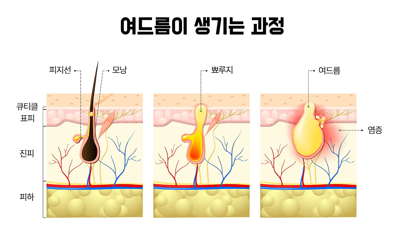 미래헬스 이미지