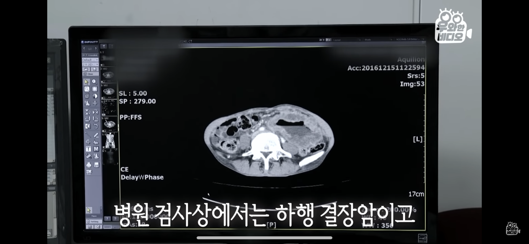 심장을 잃고도 울지 않는 11살 피아노 영재 용준이 | 인스티즈