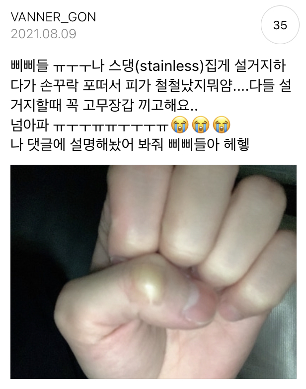 현존 남돌중에 애기어 탑티어인것 같은 남돌.jpg | 인스티즈